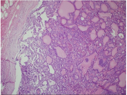 甲状腺组织.组织切片苏木精-伊红染色,放大10&times;1.